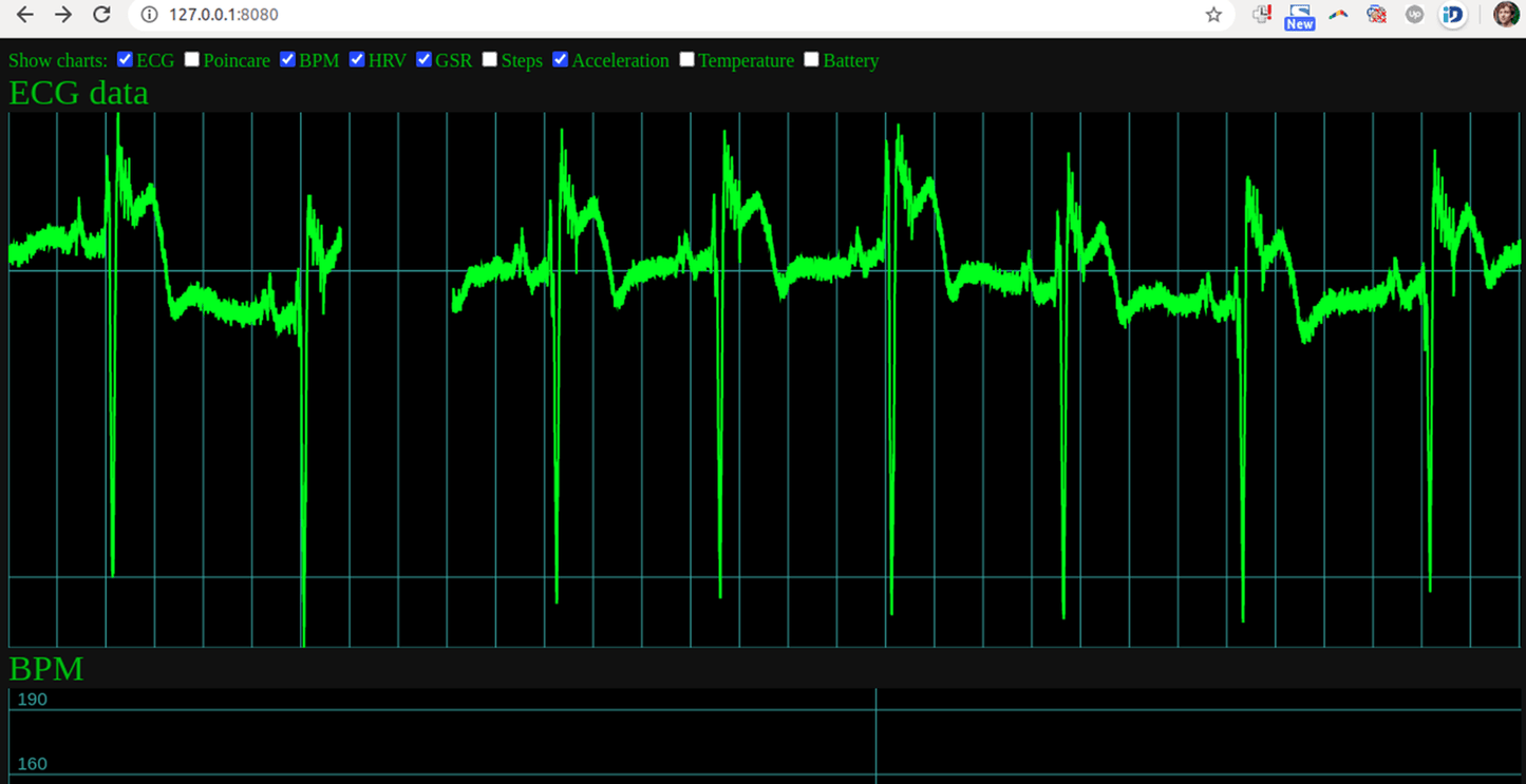 Screenshot from uECG nodejs app, showing ECG signal graph