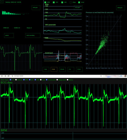 Screenshots from uECG Android app and uECG nodejs app, in one image