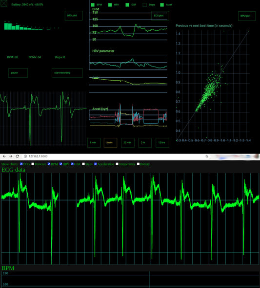 Screenshots from uECG Android app and uECG nodejs app, in one image