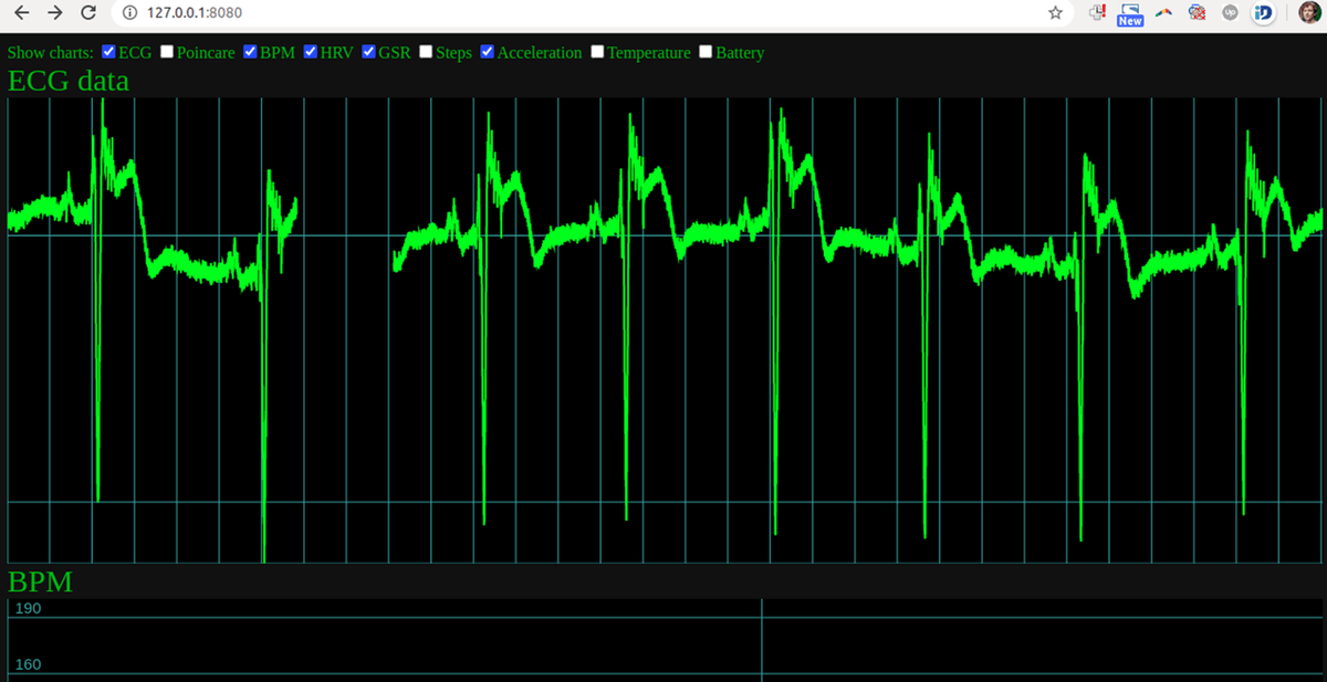 uECG - single-channel wearable ECG sensor – uDevices