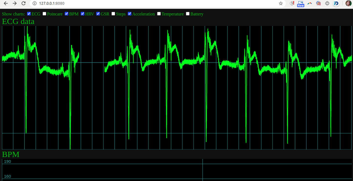 Screenshot from uECG nodejs app, showing ECG graph